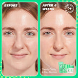 Revolution Skin Cloud Clear Niacinamide & IPC Clarifying Moisturiser