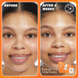 Revolution Skin Brighten Up 3% Vitamin C Brightening Serum
