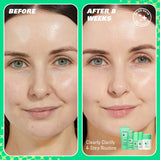 Revolution Skin Clearly Clarify 4 Step Starter Kit