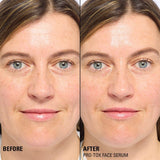 Revolution Pro Miracle Pro-Tox Fine Line Fix & Fill Serum
