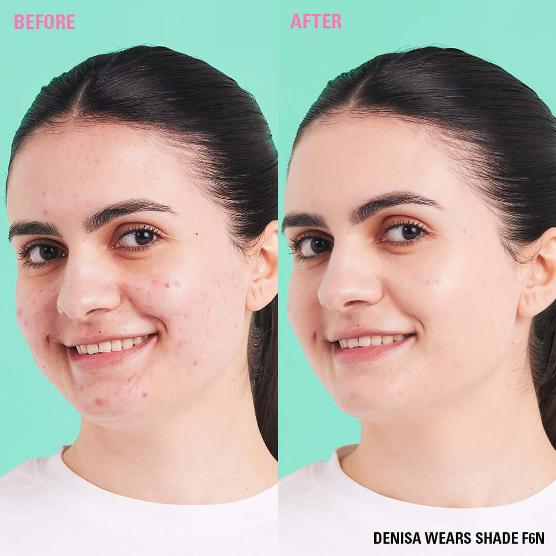 Before and after applying Revolution Conceal & Define Soft Matte Tube Foundation in shade FGN on a model.