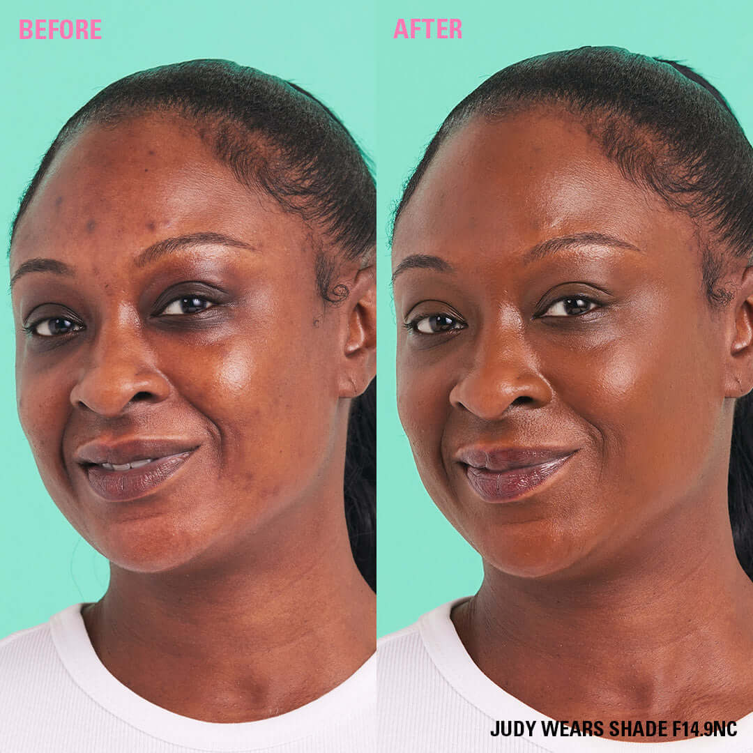Before and after using Revolution Conceal & Define Soft Matte Tube Foundation in shade F14.9NC, showcasing full coverage.