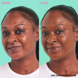 Before and after using Revolution Conceal & Define Soft Matte Tube Foundation in shade F14.9NC, showcasing full coverage.