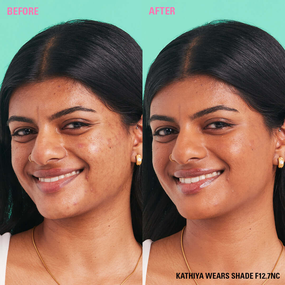Before and after using Revolution Conceal & Define Soft Matte Tube Foundation, showcasing full coverage and even skin tone.