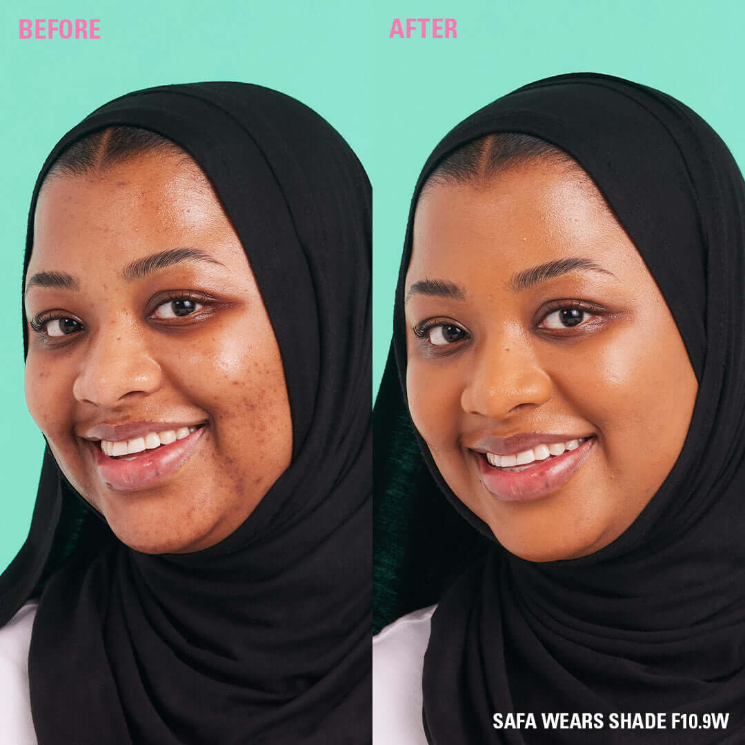 Before and after image of a model wearing Revolution Conceal & Define Soft Matte Tube Foundation in shade F10.9W.
