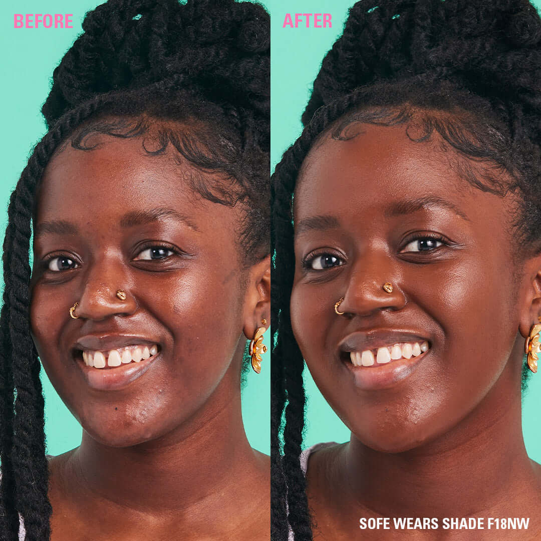 Before and after using Revolution Conceal & Define Soft Matte Tube Foundation in shade F18NW.