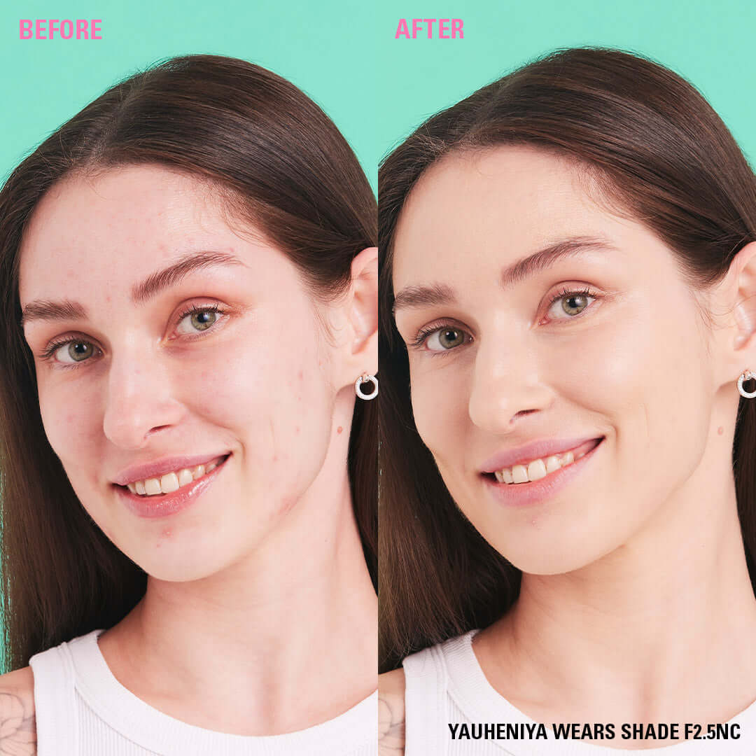 Before and after image demonstrating the Revolution Conceal & Define Soft Matte Tube Foundation on model wearing shade F2.5NC.