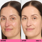Before and after results using Revolution Superfix Blur Longwear Foundation for a flawless complexion.