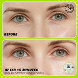 Revolution Skincare Gold Eye Hydrogel Hydrating Eye Patches with Colloidal Gold