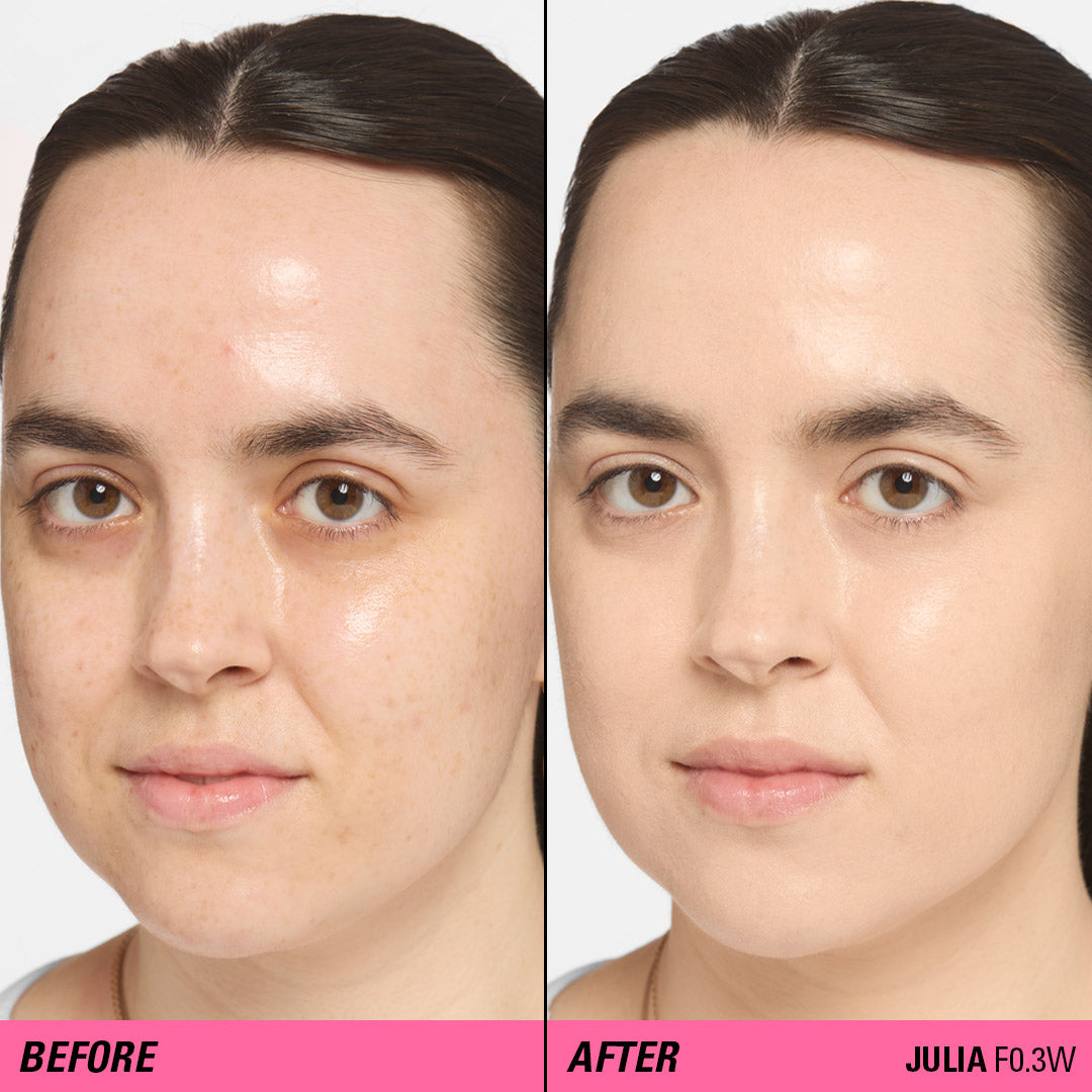 Before and after comparison using Revolution Superfix Blur Longwear Foundation on skin with imperfections.
