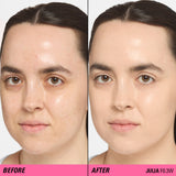 Before and after comparison using Revolution Superfix Blur Longwear Foundation on skin with imperfections.