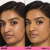 Before and after of skin using Revolution Superfix Blur Longwear Foundation, showcasing improved texture and coverage.
