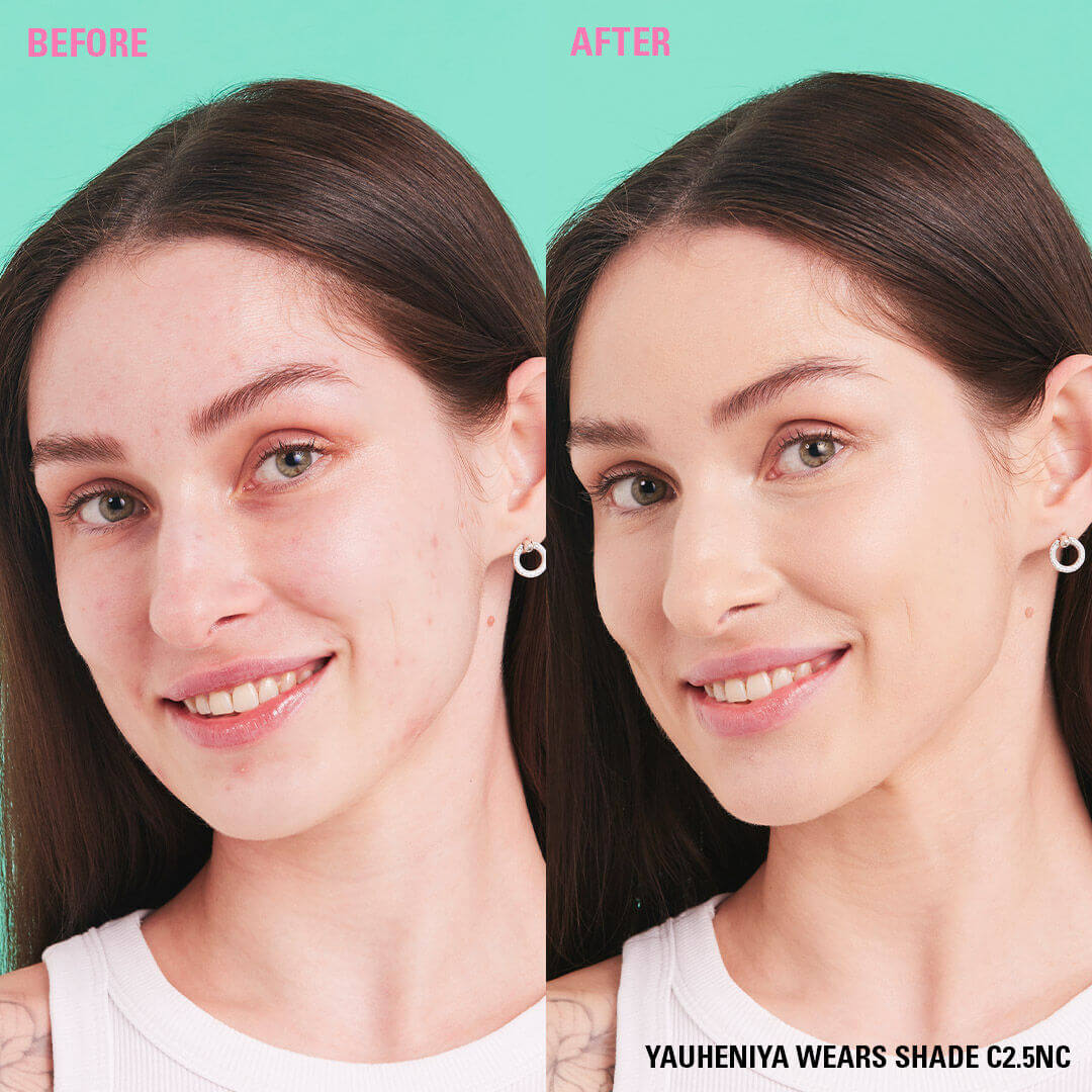 Before and after using Revolution Conceal and Define Full Coverage Concealer on model displaying shade C2.5NC
