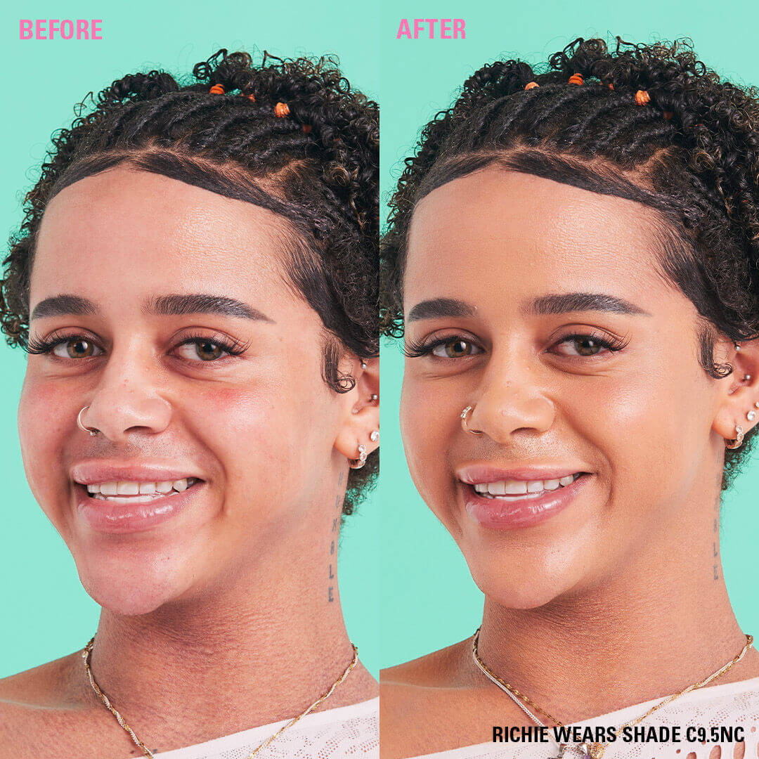 Before and after showcasing Revolution Conceal and Define Full Coverage Concealer on model wearing shade C9.5N.