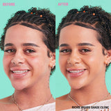 Before and after showcasing Revolution Conceal and Define Full Coverage Concealer on model wearing shade C9.5N.