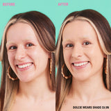 Before and after image showcasing Revolution Conceal and Define Full Coverage Concealer on model wearing shade C6.5N.