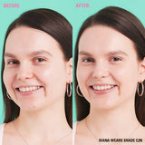 Before and after image showing results of Revolution Conceal and Define Full Coverage Concealer applied in shade C2N.