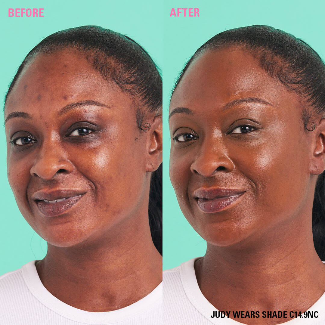 Revolution Conceal and Define Full Coverage Concealer before after comparison on model Judy wearing shade C14.9NC.
