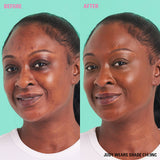 Revolution Conceal and Define Full Coverage Concealer before after comparison on model Judy wearing shade C14.9NC.