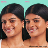 Before and after image showcasing Revolution Conceal and Define Full Coverage Concealer in shade C12.7NC.