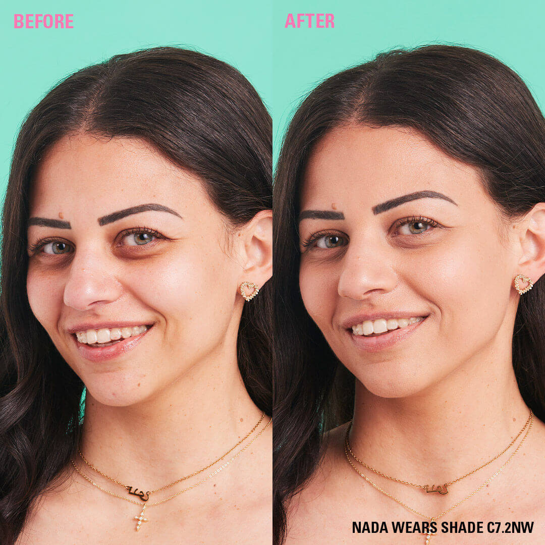 Before and after results using Revolution Conceal and Define Full Coverage Concealer in shade C7.2NW.