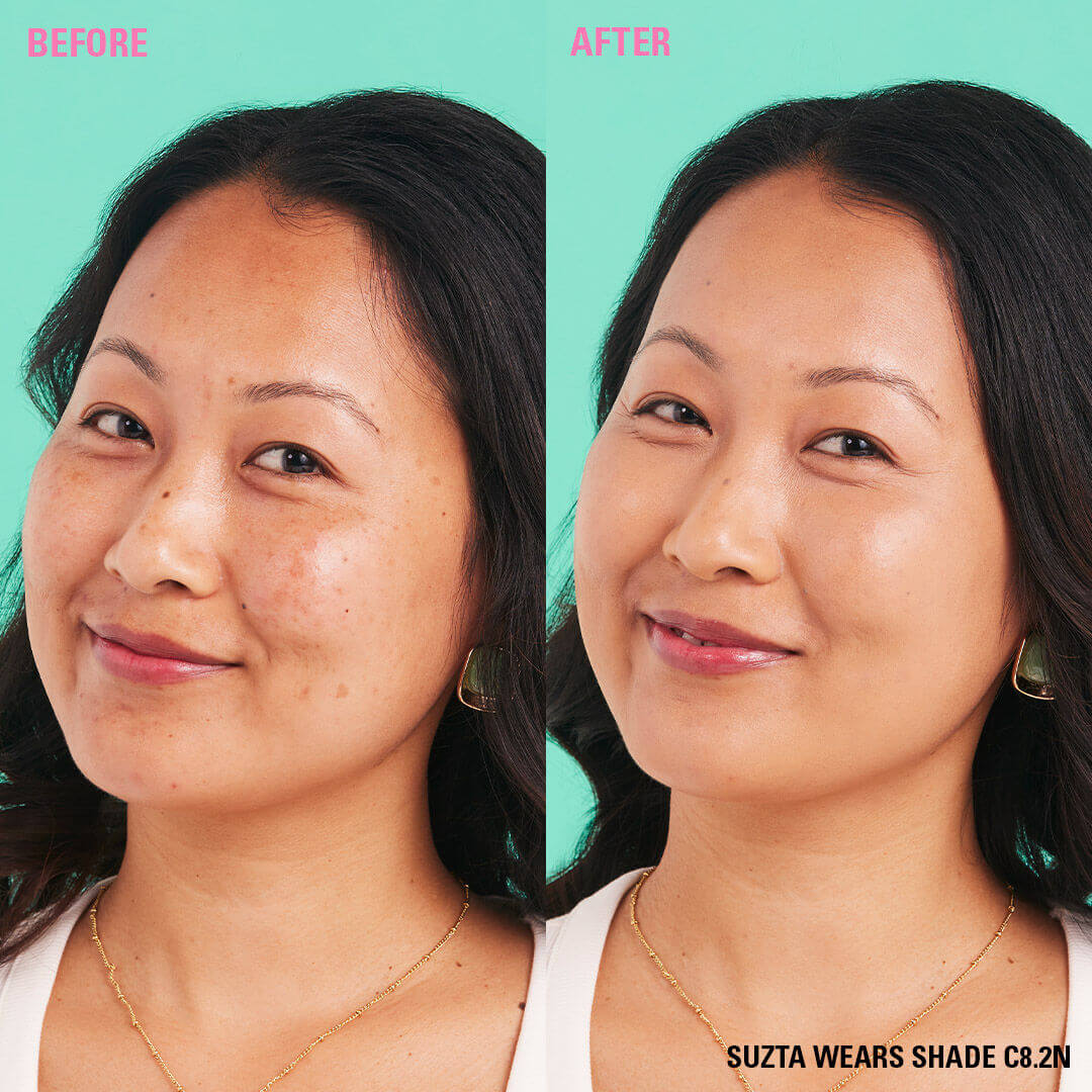 Before and after using Revolution Conceal and Define Full Coverage Concealer in shade C8.2N.