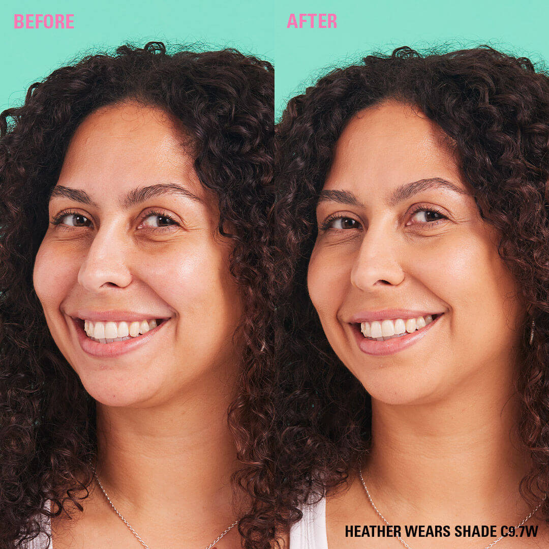 Before and after using Revolution Conceal and Define Full Coverage Concealer in shade C9.7W.