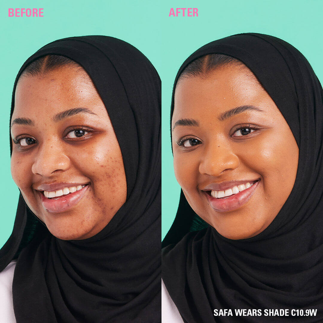 Before and after using Revolution Conceal and Define Full Coverage Concealer on skin with shade C10.9W.