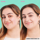 Before and after image showcasing Revolution Conceal and Define Full Coverage Concealer on model wearing shade C3N.
