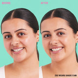 Before and after using Revolution Conceal and Define Full Coverage Concealer, showcasing clear skin improvement.