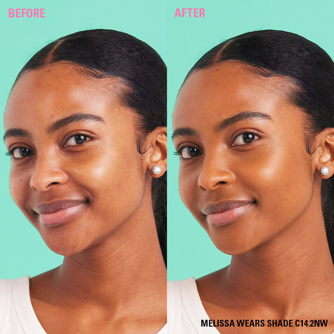 Before and after image showcasing Revolution Conceal and Define Full Coverage Concealer on model wearing shade C14.2NW.