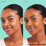 Before and after image showcasing Revolution Conceal and Define Full Coverage Concealer on model wearing shade C14.2NW.
