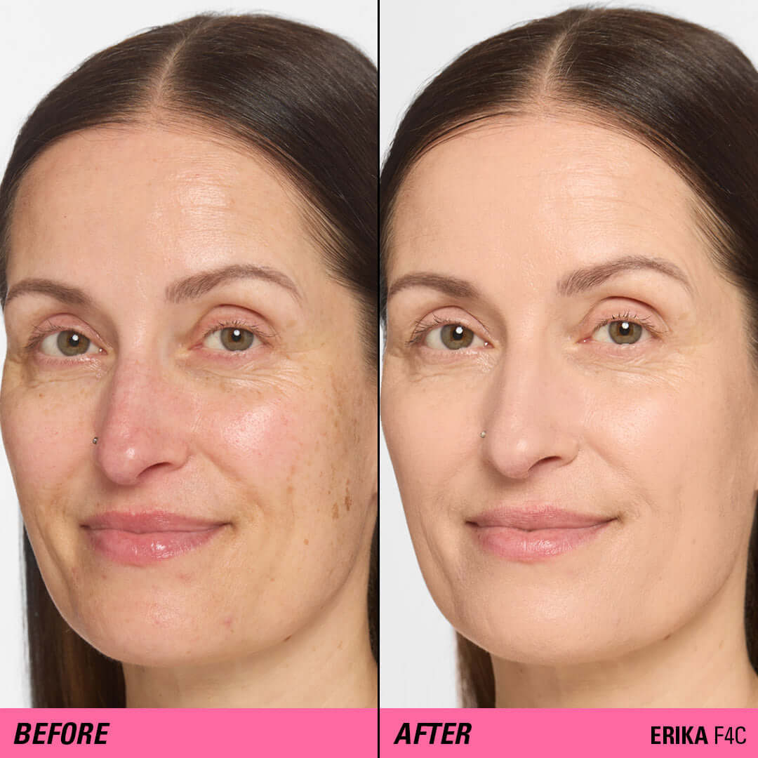 Before and after results using Revolution Superfix Blur Longwear Foundation for a flawless complexion.