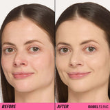 Before and after results using Revolution Superfix Blur Longwear Foundation for a flawless complexion.
