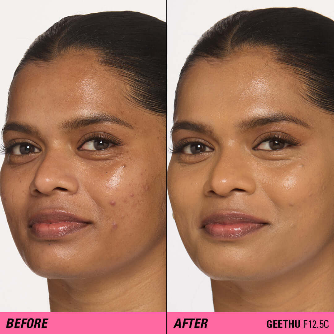 Before and after using Revolution Superfix Blur Longwear Foundation, showcasing smoother complexion and blurred imperfections.