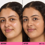 Before and after comparison using Revolution Superfix Blur Longwear Foundation on model Zoe F10N.
