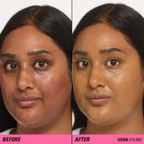 Before and after image showing transformation using Revolution Superfix Blur Longwear Foundation for a flawless finish.