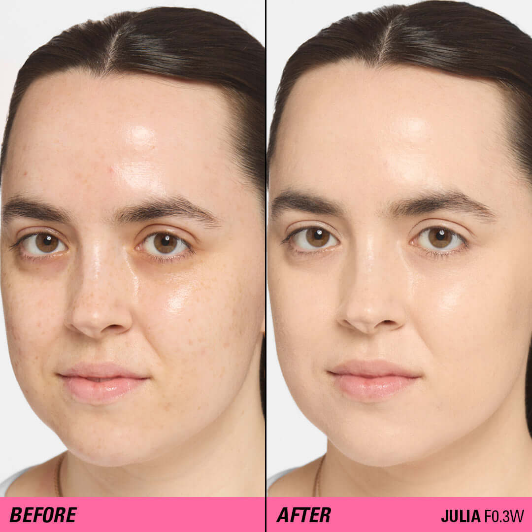 Before and after comparison using Revolution Superfix Blur Longwear Foundation on skin with imperfections.