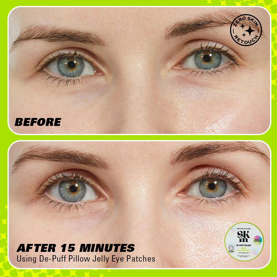 Revolution Skin De-Puff Pillow Hyaluronic Acid Jelly Eye Patches