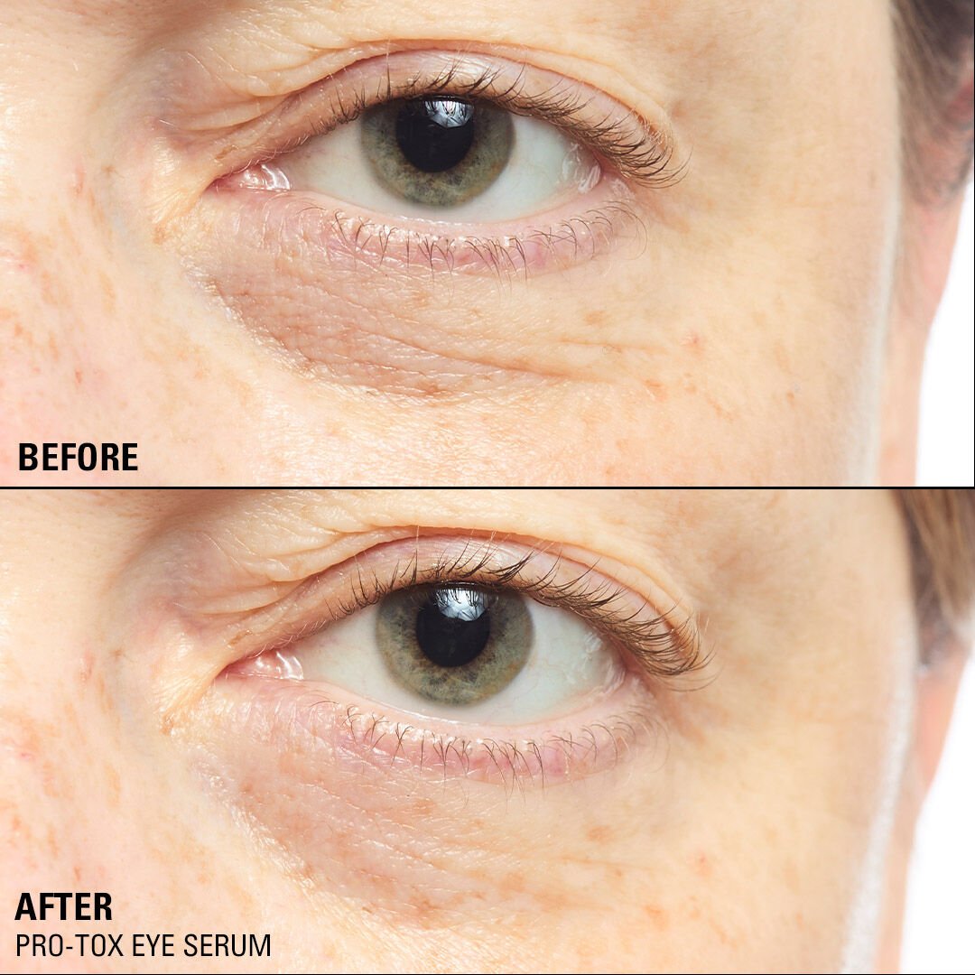 Revolution Pro Miracle Pro-Tox Instant Fix Eye Firm