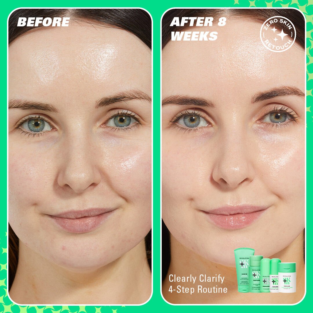 Revolution Skin Clearly Clarify 4 Step Starter Kit