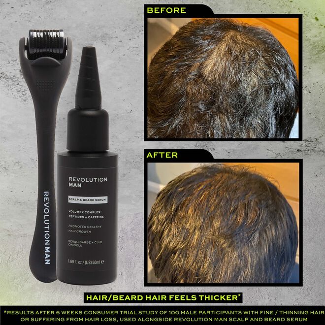 Revolution Man Fuller Thicker Hair Scalp Serum | Revolution Beauty