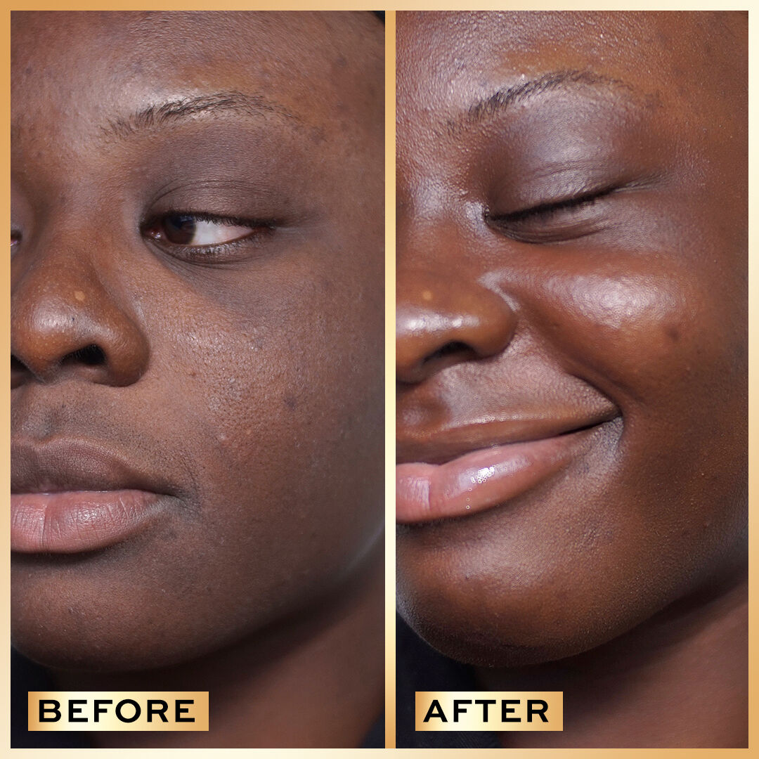 Revolution Pro Miracle Serum